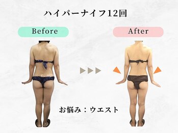 ウェリナ 一宮院/小顔矯正/骨盤矯正/痩身整体