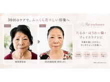 リアンシャンテ(Re enchanter)の雰囲気(70代女性|週1回×30回施術後のお写真)