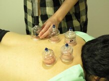 酵素風呂 和/カッピングの様子