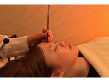 デルタエヌピー63+(δnp63+)/お客様施術例【小顔/薬院/福岡】