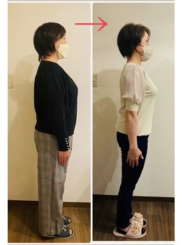 ハッピースマイル アクア(HAPPY SMILE アクア)/ビフォーアフター例