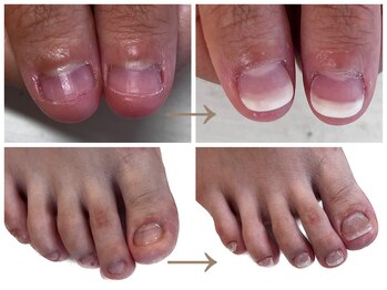 ヴェールリム(verl lim)/