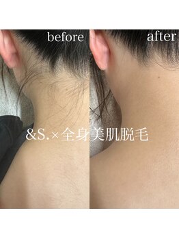 アンドエス(&S.)/自己処理が難しい箇所も!