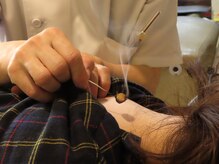 【お灸】頭痛や腹痛でお悩みの方はお灸施術もオーダーメイドで◎