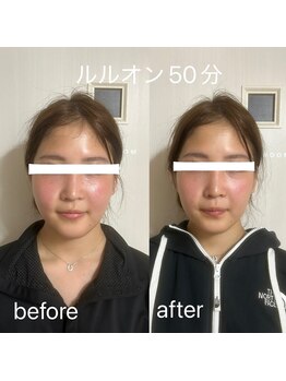 ヨサパーク アンジュ 大和田店(YOSA PARK Ange)/before・after撮影