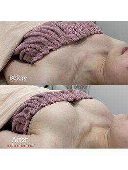 ビューティーサロン シンデレラ 心斎橋本店(Cinderella)の写真/【憧れのふわふわ美バストに♪】ハリ感とボリュームを叶える《究極のバストケア》で自慢のボディラインに♪