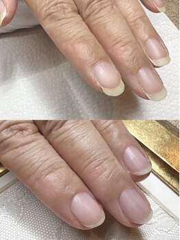 爪の悩みを解消できる（ケア含む）