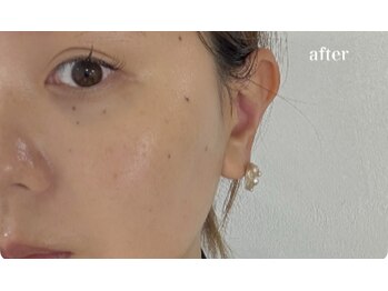 プランドール 京都店(PRENDRE)/韓国スキンケア