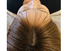 スカルプケアで頭皮から健やかな髪と肌へ