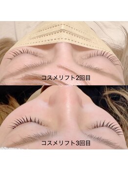 ラソ 今治店(lazo)/コスメリフト