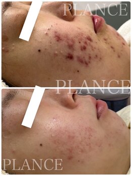 プランス 恵比寿店(PLANCE)/コツコツ積み重ねた努力の結果