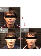 パウザ(PAUSA)/日々のお顔の変化も楽しい♪