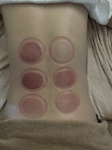 サファイア(sapphire)/真空タンクの抜缶効果: