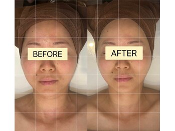 ミンガラー(Mingalar)/お客様のビフォーアフター