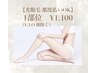 【光脱毛/都度払いOK】脱毛（顔・V.I.O除く）1部位¥1.100