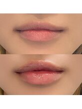 ペルレ(Perl)/唇のスペシャルケア！