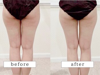 ビューティズムラウンジ(Beautism Lounge)/（脚）メニュー