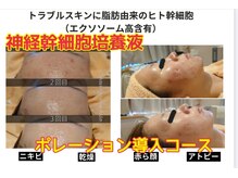 ハナン(Hanan)の雰囲気（神経幹細胞＆ポレーションで驚きのハリ肌！どんな肌悩みにも◎）