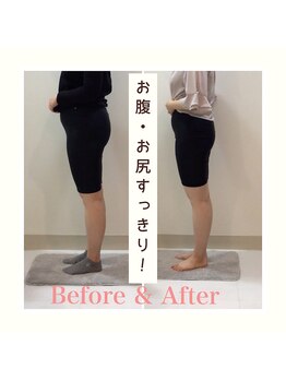 スタイルラボ高松/産後の骨盤矯正の効果♪