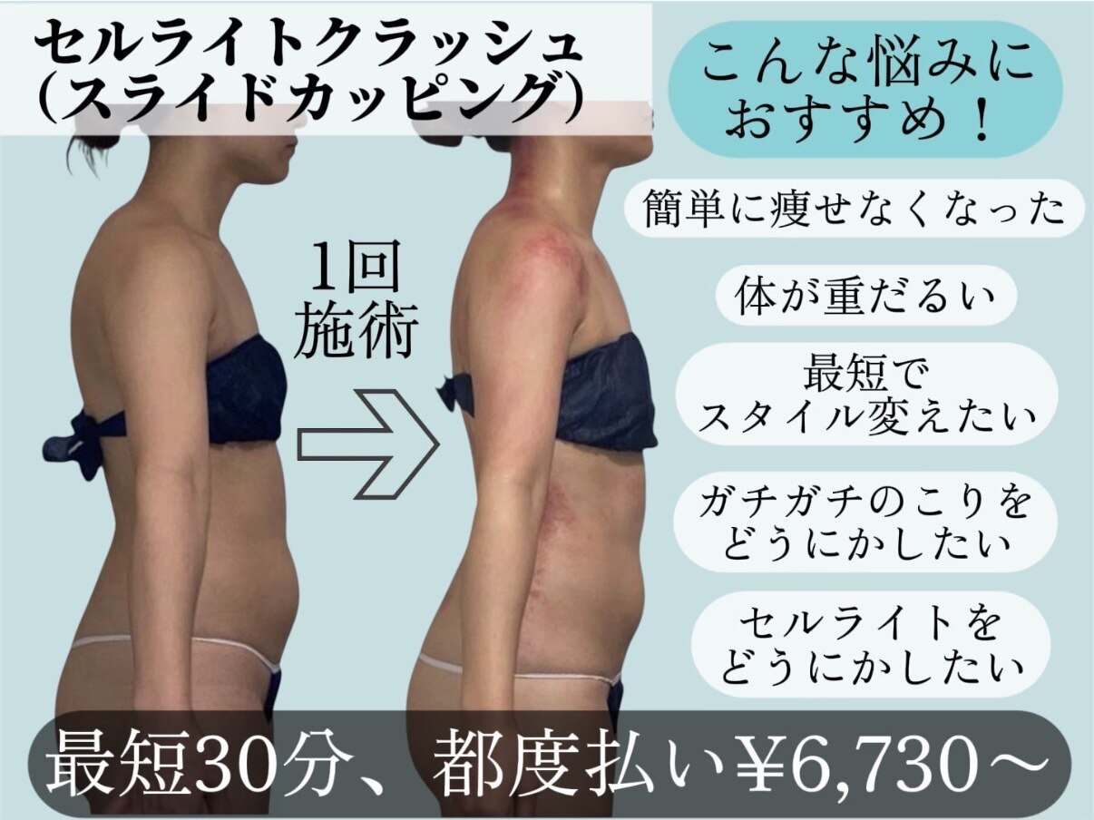 スピード美人 新宿店｜ホットペッパービューティー