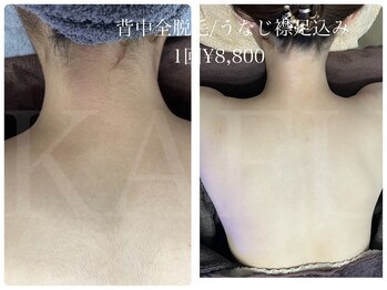 カフー(KAFUU)/産毛にも効果アリ