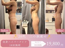 スリムプロ