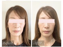 シー 下北沢(sea)/自然な若見え小顔美に