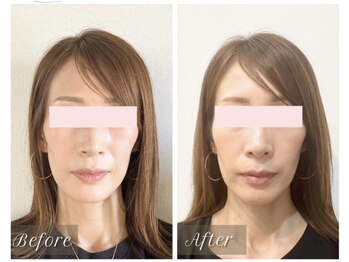 シー 下北沢(sea)/自然な若見え小顔美に