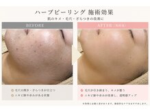 アルト(ALTO)の雰囲気（繰り返す肌荒れに終止符を！）