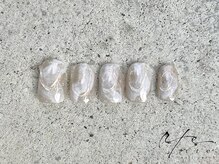 ルテ(rte)/ちぐはぐ