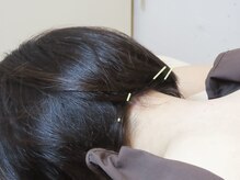 七彩鍼灸院/【鍼灸/美容鍼/恵比寿/代官山】