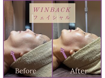 シストワ(sistoi)/スゴイ♪60代ライン引き上げ効果