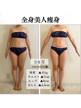 リルチェ 自由が丘(RILUCE)/全身美人痩身効果写真