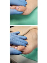 巻き爪補正店 西宮北口店/タコ・魚の目