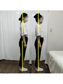 サンイチゼロ(310)の写真/自己投資!【姿勢分析付き!姿勢・骨盤矯正+小顔矯正120分¥12000】スタイルUP＆美しい姿勢へ!ブライダルも◎