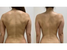 ニコ(25)/通い始めて2か月