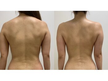 ニコ(25)/通い始めて2か月