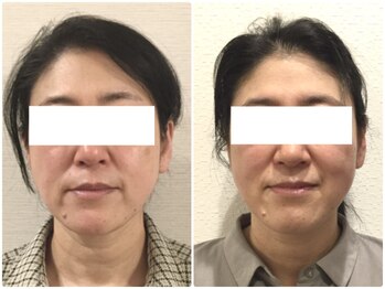 美容整体 ウェリナ 蟹江院/小顔矯正/骨盤矯正/美脚サロン 