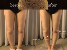 リムーン(REMOON.)/施術後の効果★