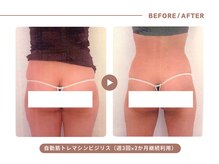 イエス マイサロン(yes My Salon)/自動筋トレマシンBIJIRIS施術例