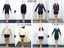 [小顔矯正 骨盤矯正 美容矯正] 銀座 美.design 熊本下通店 【7/9 NEW OPEN（予定）】/☆美脚O脚+骨盤矯正Before-After