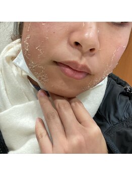 ラクシュミー ナチュラル(Laksmy NATURAL)/ハードトリートメント