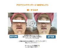 チロル(CHIROL)/むくみ改善☆