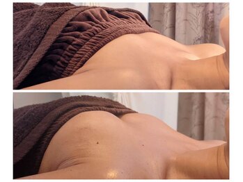 エル(eL)/Before/After