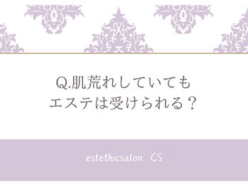 エステティックサロン シーズ/Q.肌荒れしていてもエステOK？
