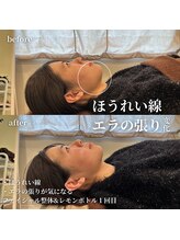 フェアリーフェイス 南森町店(Fairy Face)/南森町/小顔矯正&レモンボトル