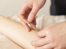 武蔵小杉鍼灸接骨院/肩こり・首こり解消