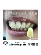 ホワイトニングカフェ 岸和田店(WhiteningCafe)/Wホワイトニング8回照射