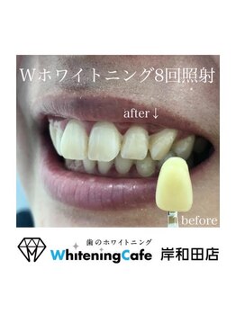 ホワイトニングカフェ 岸和田店(WhiteningCafe)/Wホワイトニング8回照射