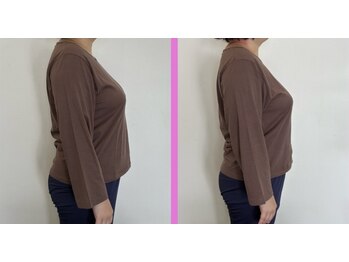 リセットモア(Reset More)/before after 1回の施術の変化